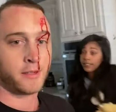  Chet Hank, en marzo de 2021, compartió un video en el que afirma que su ex novia lo atacó con un cuchillo.